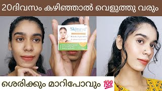 30 Days വെല്ലുവിളി permanent skin whitening and remove pimplesഓരോദിവസവും വെളുക്കുന്നത് കാണാം😱 [upl. by Manda54]