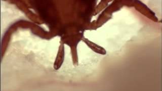 The process of attachment of a nymphal Ixodes ricinus tick to host skin [upl. by Nil]