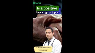 Is a positive ANA a sign of lupus  Best Rheumatologist in Gurgaon Dr Naval Mendiratta lupus [upl. by Rahel]