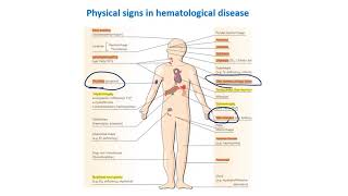 Hematology The Big Picture Clinical amp Intro to WBCs disorders [upl. by Cordier]