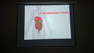 TOMOGRAFÍA DE ABDOMEN Y PELVIS ANATOMIA Y REALIZACION DESDE EL AULA [upl. by Aenaj928]