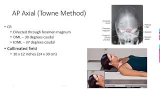 Radiographic Positioning of the Skull [upl. by Dikmen]