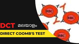 DCTDirect Coombs test മലയാളം [upl. by Lecrad]