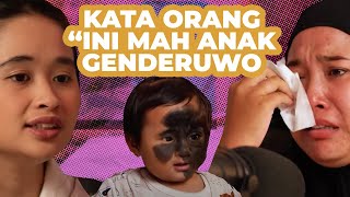 TANDA LAHIR HITAM SETENGAH MUKA ORANG BILANG ANAK GENDERUWO GritteBukaPraktek [upl. by Enicul]