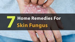 7 Home Remedies For Skin Fungus That Actually Work ✦ Dr Laelia ✦ [upl. by Leidag493]