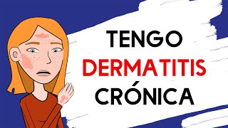 Tengo dermatitis crónica [upl. by Aehtrod]