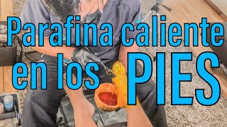 Parafina en los pies para talones agrietados y resecos [upl. by Bertrando]