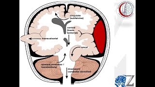 Intracranial Pressure 5 Herniation Syndromes 2 ضغط المخ [upl. by Malca570]