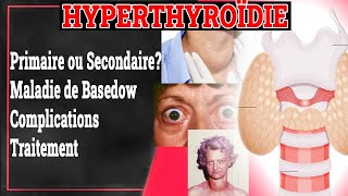 Hyperthyroïdie Maladie de Basedow Nodules Toxiques Traitement  Endocrinologie Medicale [upl. by Tonkin]