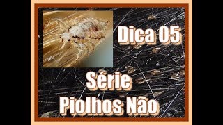 Série Piolhos Não Dica 05  Detergente Neutro piolhoselendeas voltaasaulas [upl. by Anayk853]