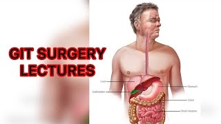 GIT SURGERY LECTURES Acute Abdomen surgerylectures surgery acuteabdomen surgery [upl. by Anerbes]