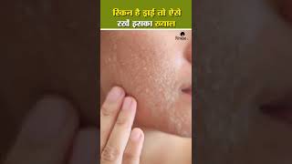 गर्मियों में Dry Skin का ऐसे रखें ख्याल dryskinrelief dryskinproblems skincare skincareroutine [upl. by Assetal361]