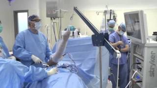 Shoulder Arthroscopy Surgery [upl. by Neelyar947]