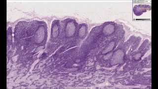 Histologia Humana  Linfonodo [upl. by Knowle]