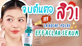 ลองรักษาสิวด้วย Effaclar Serum ปิดจบต้นตอของสิว  MAYNESSA [upl. by Dietz]