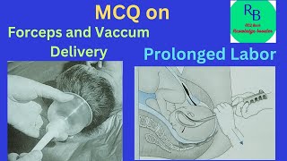 MCQ on Forceps deliveryVacuum delivery and Prolonged Labor RB MCQ Bank Knowledge Booster [upl. by Zurn339]