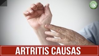 ARTRITIS Sintomas y Causas  Artritis Reumatoide [upl. by Birkner]