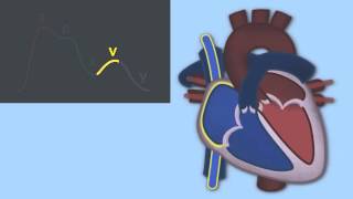 Interpreting Central Venous Pressure Waveforms by J DiNardo  OPENPediatrics [upl. by Pacificia362]