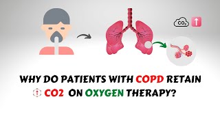 Oxygen Induced CO2 Narcosis in COPD Patients [upl. by Sedecrem425]