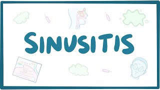 Sinusitis  causes symptoms diagnosis treatment pathology [upl. by Notserk]