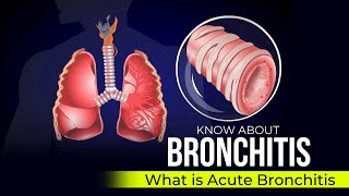 Bronchitis  Acute Bronchitis [upl. by Lanahtan]