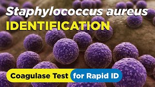 How to identify Staphylococcus aureus using the Coagulase Test  Slide and Tube Method [upl. by Fredia]