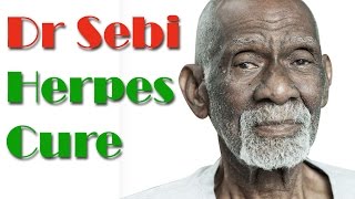 Dr Sebi Herpes Treatment  Natural Treatment For Herpes By Dr Sebi [upl. by Crespi]