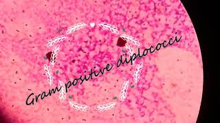 Gram positive diplococci steptococcus pneumoniae [upl. by Eseeryt]