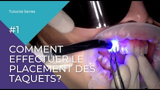 Comment effectuer le placement des taquets [upl. by Adyaj]