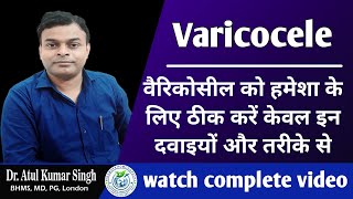 वेरीकोसिल के कारण और निवारण  Understanding and Managing Varicocele A Comprehensive Guidequot [upl. by Eseryt]