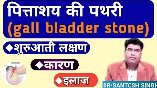 What are Gallbladder stone Cholelithiasis Cause Symptoms amp Treatment   in Hindi [upl. by Everson99]