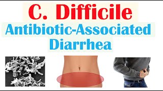 Clostridium Difficile AntibioticAssociated Diarrhea Risk Factors Symptoms Diagnosis Treatment [upl. by Novi]