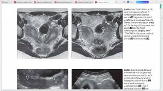 GYNAE IMAGING DIAGNOSTIC IMAGING SERIES [upl. by Ddej]