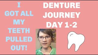 Teeth are gone dental journey no immediate dentures Day 12 Life with Dentures [upl. by Halet]