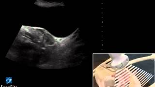 3D Cómo hacer Examen ecográfico de la Pelvis en Mujer  Ultrasonido SonoSite [upl. by Atsiuqal650]