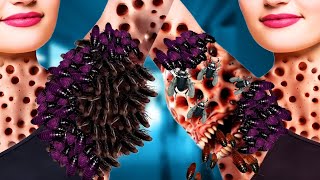 ASMR Animated Body and Belly Treatment Removing Infections  Maggots ampWorms [upl. by Nagaet]