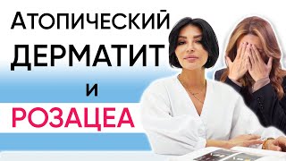 Какие диетические привычки и уход могут спасти вашу кожу [upl. by Aivatnuahs]