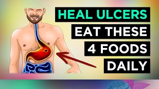 4 Foods To HEAL Stomach Ulcers Eat These Everyday [upl. by Klinges]