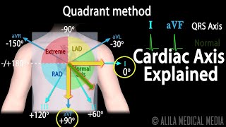 Cardiac Axis Interpretation Animation [upl. by Agon211]