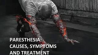 Paresthesia Causes Symptoms and Treatment [upl. by Enerual]