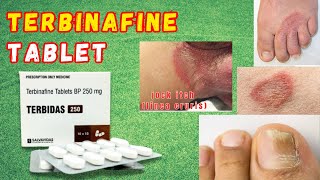 Terbinafine Tablet  Terbinafine Antifungal Drug  Terbinafine Tablets ip 250 mg [upl. by Renner]