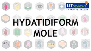 Hydatidiform Mole [upl. by Atinar]