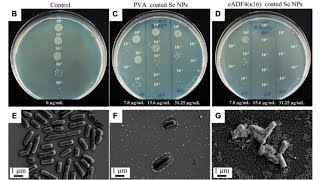 Quantification of Microorganisms CFU [upl. by Orodoet]