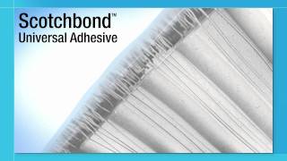 Scotchbond™ Universal Adhesive Introduction [upl. by Rimahs]