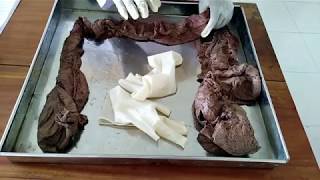 Large intestine bangla demo [upl. by Audre]