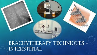 Brachytherapy Lecture No 2 Interstitial Brachytherapy [upl. by Yentiw]