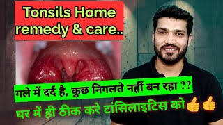 टॉन्सिलाइटिस घरेलू उपचार  Tonsillitis Home Remedies and care [upl. by Ynettirb]