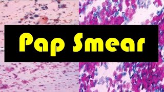 Pap Smear  Pap Test  Pap Smear Procedure  The Role of Pap Smear in Cervical Screening [upl. by Anelahs]