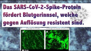 Gerinnselbildung „Clots“ durch SpikeProtein Reaktion auf Studie Blutgerinnung Thrombozyten Clots [upl. by Nader322]