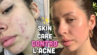 LA MIA SKIN CARE CONTRO LACNE [upl. by Beattie]